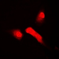 Anti-HOS Antibody