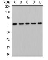 HARS2 Rabbit Polyclonal Antibody