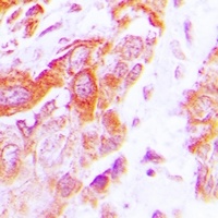 Anti-AspRS Antibody