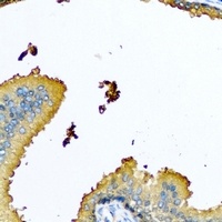 Anti-Nyctalopin Antibody