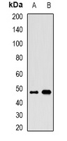 ALG2 Rabbit Polyclonal Antibody