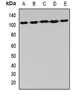 AlaRS Antibody
