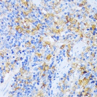AlaRS Antibody