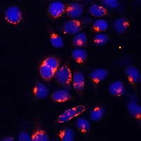 AlaRS Antibody