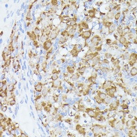Anti-ACAT2 Antibody