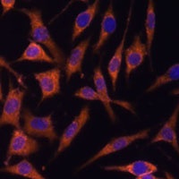 Anti-ACAT2 Antibody
