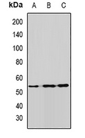 ALDH9A1 Rabbit Polyclonal Antibody