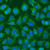 Anti-eIF2B1 Antibody