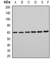 EYA3 Rabbit Polyclonal Antibody