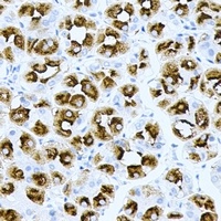 Anti-H-Ras Antibody
