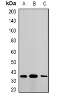 Metaxin-1 Rabbit Polyclonal Antibody