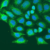 Anti-Metaxin-1 Antibody