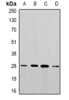PGAM2 Antibody