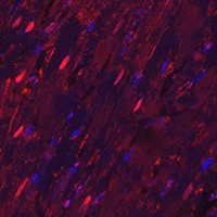 Anti-PGAM2 Antibody