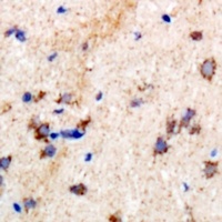 Anti-PSPH Antibody