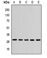 SPR Rabbit Polyclonal Antibody