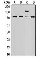 NSD2 Rabbit Polyclonal Antibody