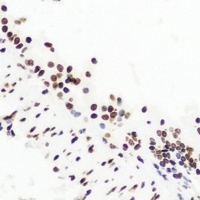 Anti-NSD2 Antibody