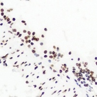 WHSC1 antibody