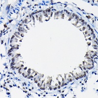 SSNA1 antibody