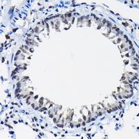 Anti-SSNA1 Antibody
