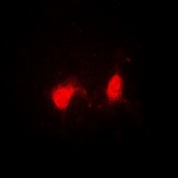 Anti-SSNA1 Antibody