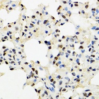 Anti-KDM4A Antibody