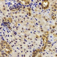 Anti-DDX39A Antibody