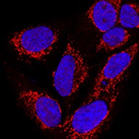Anti-Metaxin-2 Antibody