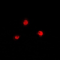Anti-PRDM7 Antibody