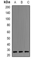 B9D1 Rabbit Polyclonal Antibody
