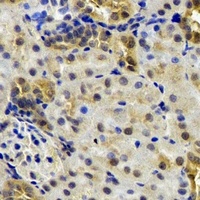 Anti-B9D1 Antibody