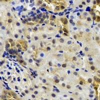 B9D1 antibody