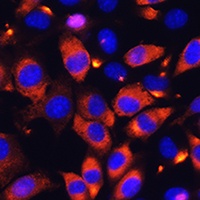 Anti-B9D1 Antibody