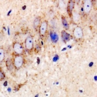 Anti-USP25 Antibody