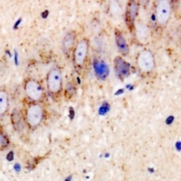 USP25 antibody