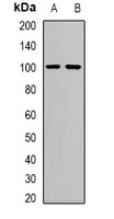 Neutral Ceramidase Rabbit Polyclonal Antibody