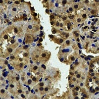 CALCOCO1 antibody