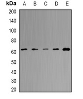 MCCB Rabbit Polyclonal Antibody