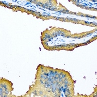 MCCB Rabbit Polyclonal Antibody