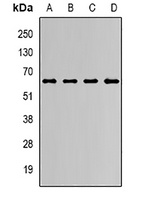 JMJD4 Rabbit Polyclonal Antibody