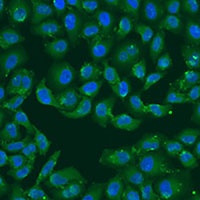 Anti-MSRB3 Antibody