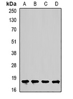 Cofilin 2 Rabbit Polyclonal Antibody