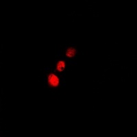 Cofilin 2 Rabbit Polyclonal Antibody
