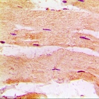 Anti-MBNL1 Antibody