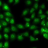 Anti-MBNL1 Antibody