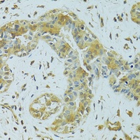 MTCH1 antibody