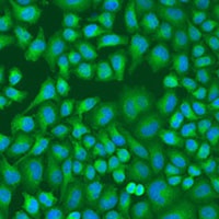 Anti-LLGL2 Antibody