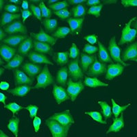Anti-CapZ beta Antibody