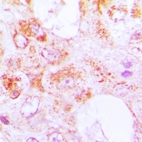 CETN3 antibody